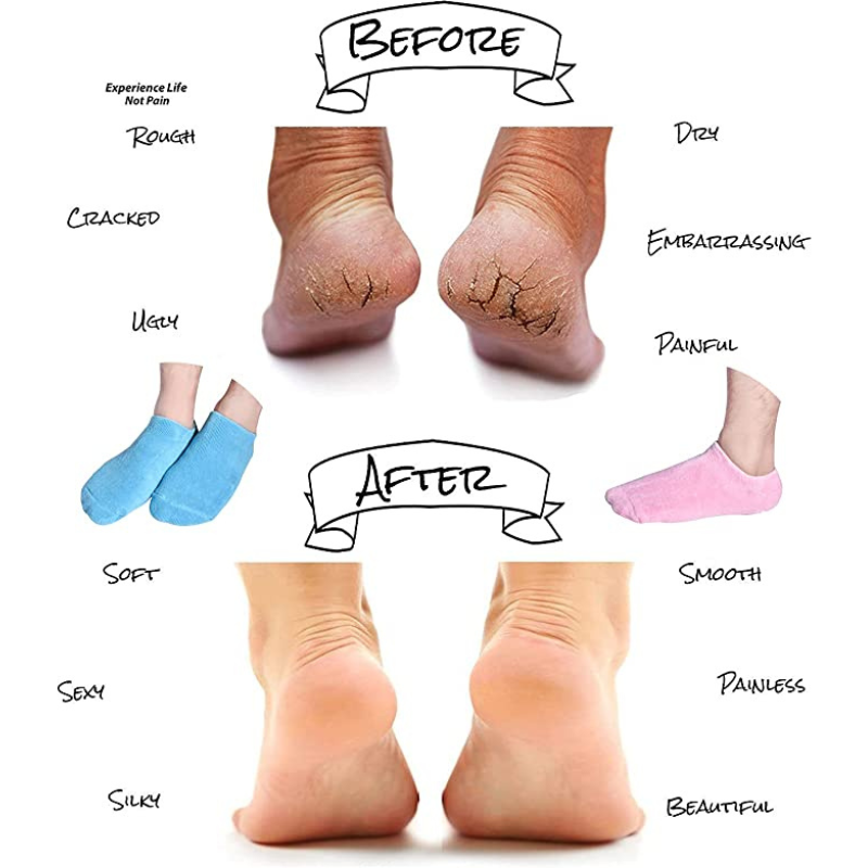 ZenToes Moisturizing Heel Socks, Treat Dry Cracked Heels 2 Pair (Regular,  Cotton Gray/Black), 4 - Pay Less Super Markets